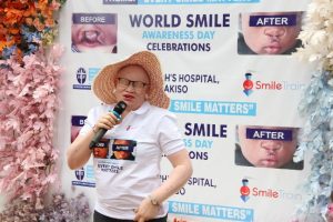 Diana Bakuyita The co-founder and Business Manager of Mama Mzungu, and co-founder of Women and Children with Albinism in Uganda (WACWAU), during the World Smile Day celebrations at St. Joseph’s Hospital Wakiso.